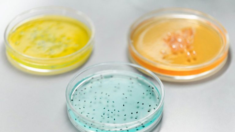 Microbes